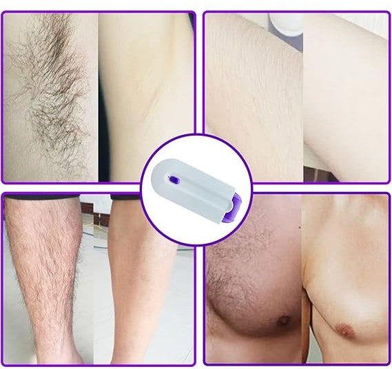 ✨ Mini Depiladora Yes Láser Recargable: Piel Suave, Sin Dolor, En Minutos ✨