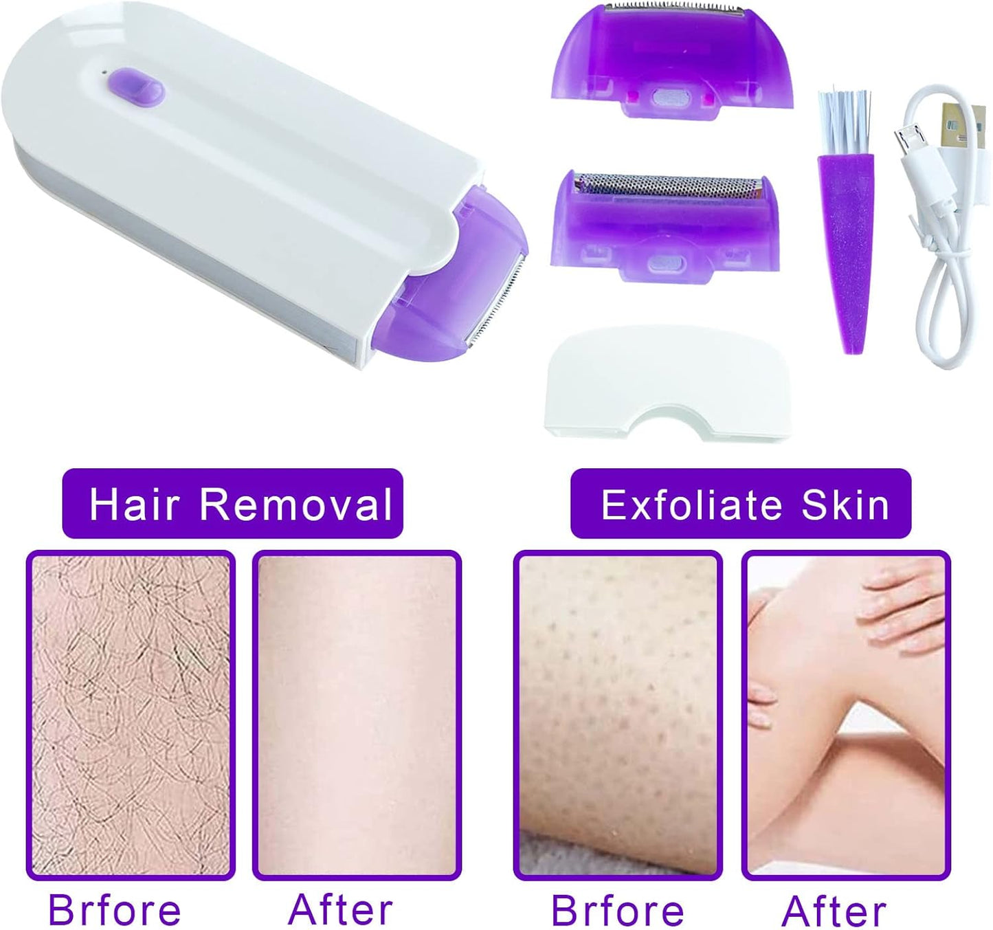 ✨ Mini Depiladora Yes Láser Recargable: Piel Suave, Sin Dolor, En Minutos ✨
