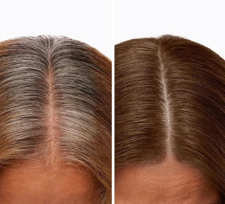Chao Canas Plus | Incluye Obsequios