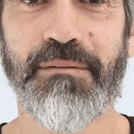 Chao Canas Plus | Incluye Obsequios